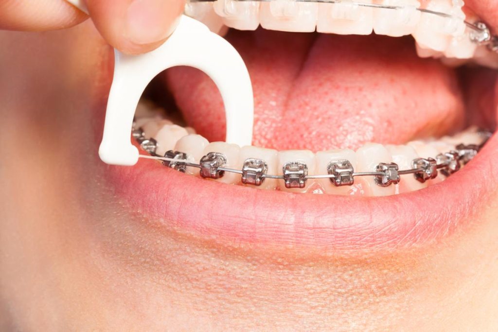 Common Orthodontic Issues in El Paso, TX Mejia Maidl Orthodontics